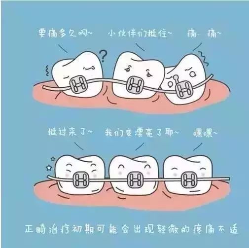 什么情况下牙齿矫正容易反弹?